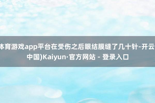 体育游戏app平台在受伤之后眼结膜缝了几十针-开云(中国)Kaiyun·官方网站 - 登录入口